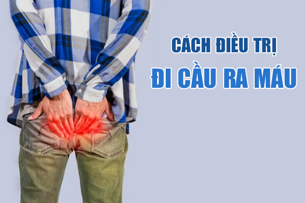 Cách điều trị đi cầu ra máu tươi hiệu quả, ngăn ngừa tái phát