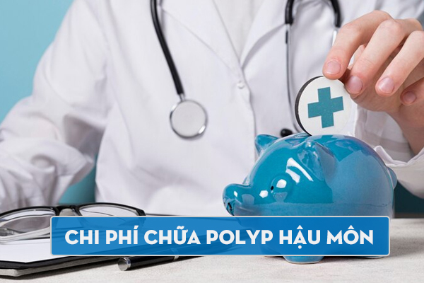 Chi phí chữa Polyp hậu môn bao nhiêu tiền? Cập nhật bảng giá mới