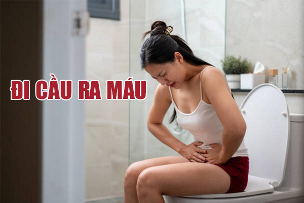 Đi cầu ra máu cuối bãi là bị gì? Cách chữa trị hiệu quả