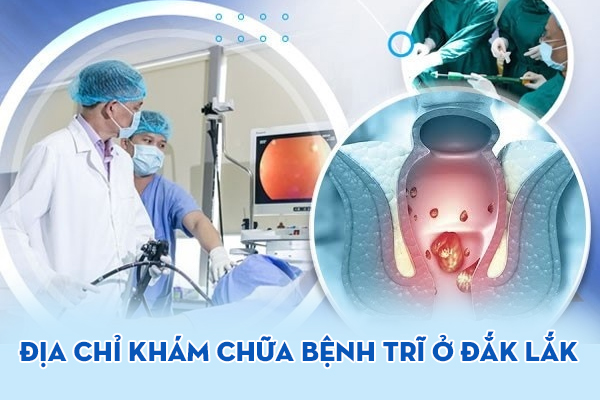 Địa chỉ khám chữa bệnh trĩ Đắk Lắk chất lượng, có khám ngoài giờ