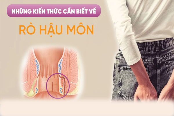 Rò hậu môn – Nguyên nhân, dấu hiệu và cách chữa trị hiệu quả